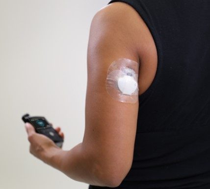 Persona con sensor de monitoreo continuo de glucosa en el brazo